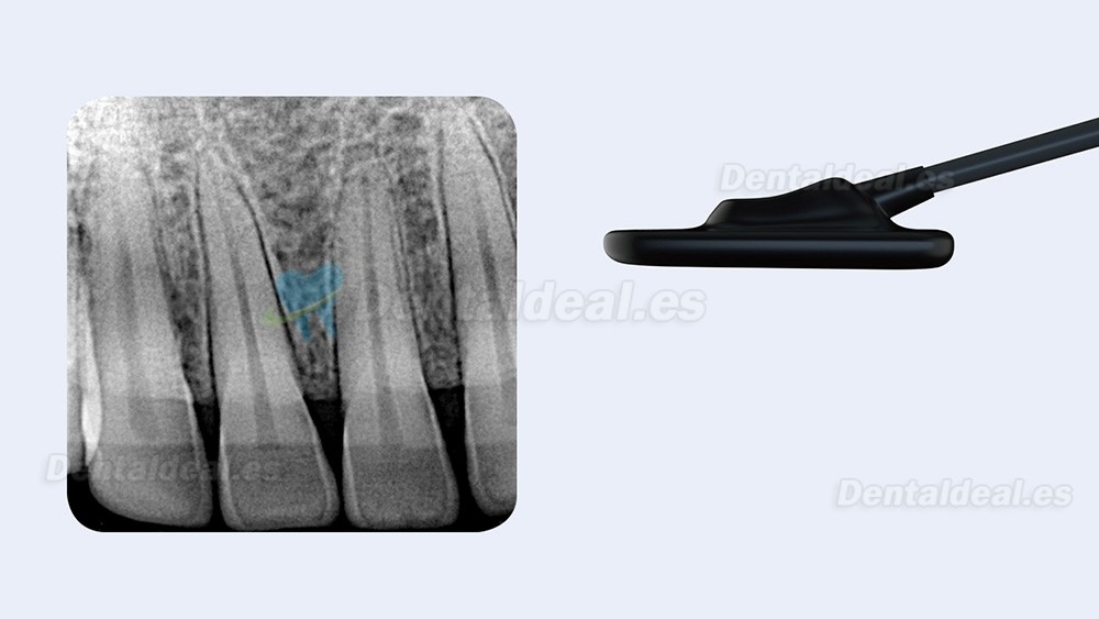 Refine Sensor intraoral DynImage Sensor de Rayos X Dental Digital